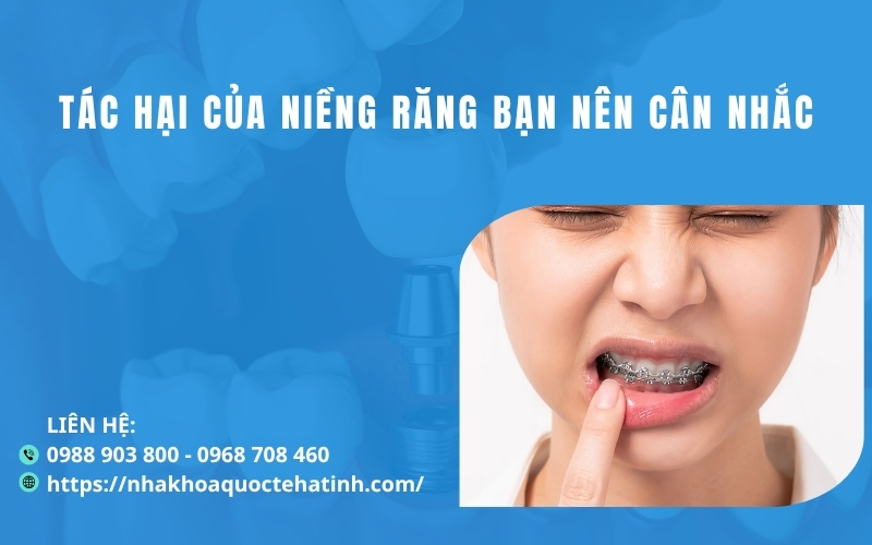 Tác hại của niềng răng bạn nên biết