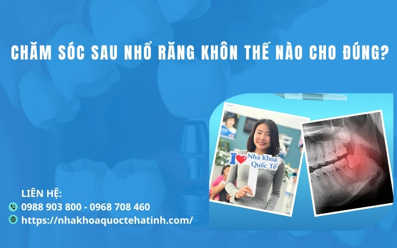 Chăm sóc sau nhổ răng khôn thế nào cho đúng?