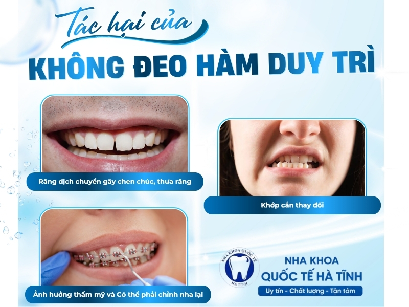 Không đeo hàm duy trì đúng chỉ định có thể khiến răng dịch chuyển, ảnh hưởng kết quả chỉnh nha và khớp cắn