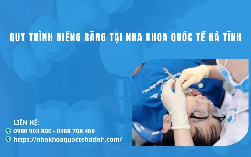 Quy trình niềng răng tại Nha Khoa Quốc Tế Hà Tĩnh