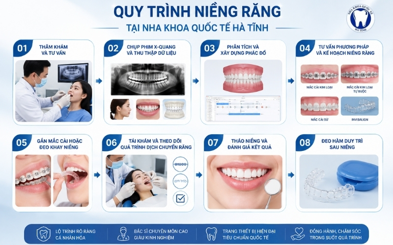 Quy trình niềng răng tại Nha Khoa Quốc Tế Hà Tĩnh được xây dựng phù hợp với tình trạng răng và mục tiêu điều trị của từng người