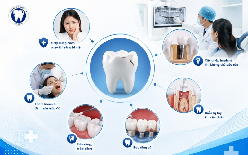 Xử lý răng mẻ, gãy đúng cách giúp hạn chế tổn thương và bảo tồn răng thật tối đa
