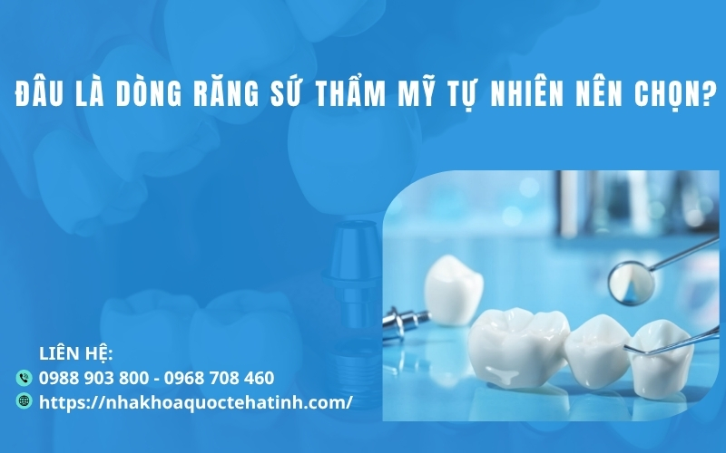 Đâu là dòng răng sứ thẩm mỹ tự nhiên nên chọn?