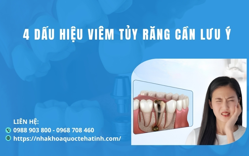 4 dấu hiệu viêm tủy răng cần lưu ý