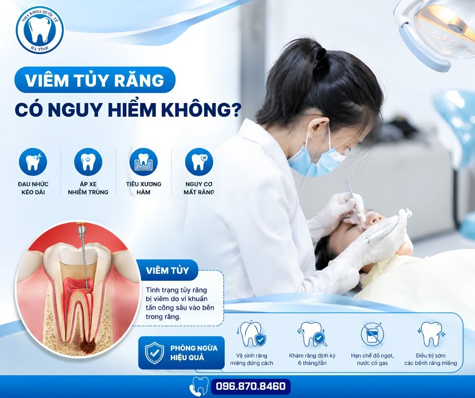 Viêm tủy răng kéo dài có thể gây áp xe, nhiễm trùng và tăng nguy cơ mất răng